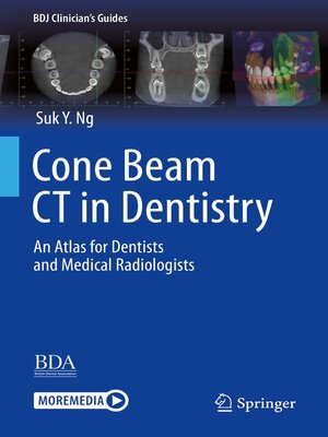 cover image of Cone Beam CT in Dentistry